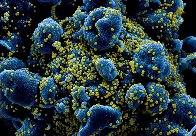 Tìm ra điểm yếu của virus SARS-CoV-2