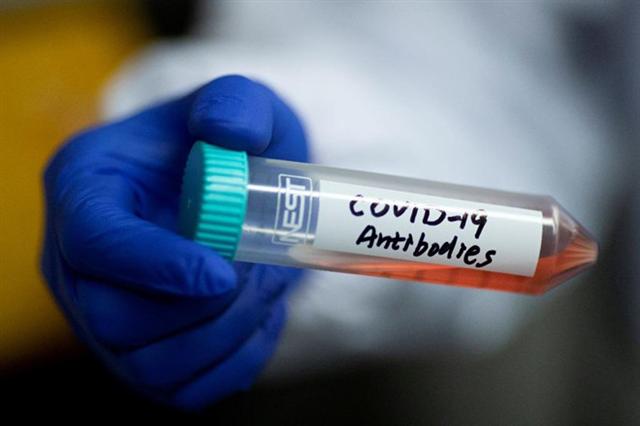 Israel đã cô lập được kháng thể đơn dòng của virus gây Covid-19