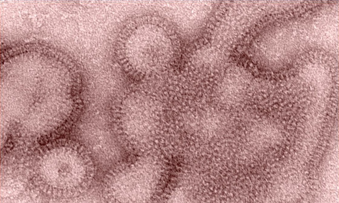 <p>
<strong>Dịch cúm Hồng Kông hoặc H3N2 (1968 - 1970)</strong></p><br /><br /><p class="Normal">50 năm sau bệnh cúm Tây Ban Nha, một loại virus cúm khác, H3N2, đã lây lan khắp thế giới. Khoảng một triệu người chết trên toàn thế giới, trong đó có khoảng 100.000 người ở Hoa Kỳ.</p><p class="Normal">Đại dịch năm 1968 là đại dịch cúm thứ ba trong thế kỷ 20, hai đại dịch còn lại là cúm Tây Ban Nha năm 1918 và đại dịch cúm châu Á năm 1957. Loại vi rút gây ra đại dịch cúm châu Á được cho là đã tiến hóa và tái xuất hiện cách đây mười năm trong hình thức của cái gọi là "cúm Hồng Kông", dẫn đến đại dịch H3N2. Tuy nhiên, thế kỷ XXI tiếp tục chứng kiến ​​dịch cúm xuất hiện.</p><p class="Normal">Mặc dù ít gây tử vong hơn so với dịch cúm năm 1918, nhưng cúm H3N2 lại rất dễ lây lan: 500.000 người đã bị nhiễm trong vòng hai tuần kể từ trường hợp đầu tiên được báo cáo ở Hồng Kông. Đại dịch đã giúp cộng đồng y tế toàn cầu hiểu được vai trò sống còn của vắc xin trong việc ngăn chặn các dịch bệnh trong tương lai.<br /><br /><em>Ảnh: Một hình ảnh dưới kính hiển vi điện tử do Trung tâm Kiểm soát và Phòng ngừa Dịch bệnh Hoa Kỳ cung cấp vào năm 2011 cho thấy vi rút cúm H3N2. </em></p>
