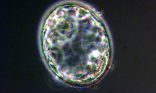 <p>
Trong hình là một phôi nang - một trong những giai đoạn đầu tiên của quá trình phát triển phôi, một vài ngày sau khi tế bào trứng và tinh trùng hợp nhất trong quá trình thụ tinh.</p><p class="Normal">Một phôi nang người có khoảng 200 tế bào. Và bằng hai phần mười đường kính của sợi tóc.</p>