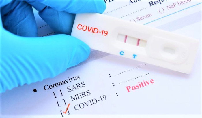 Giá kit test COVID-19 'nhảy múa', quản lý thị trường yêu cầu kiểm tra