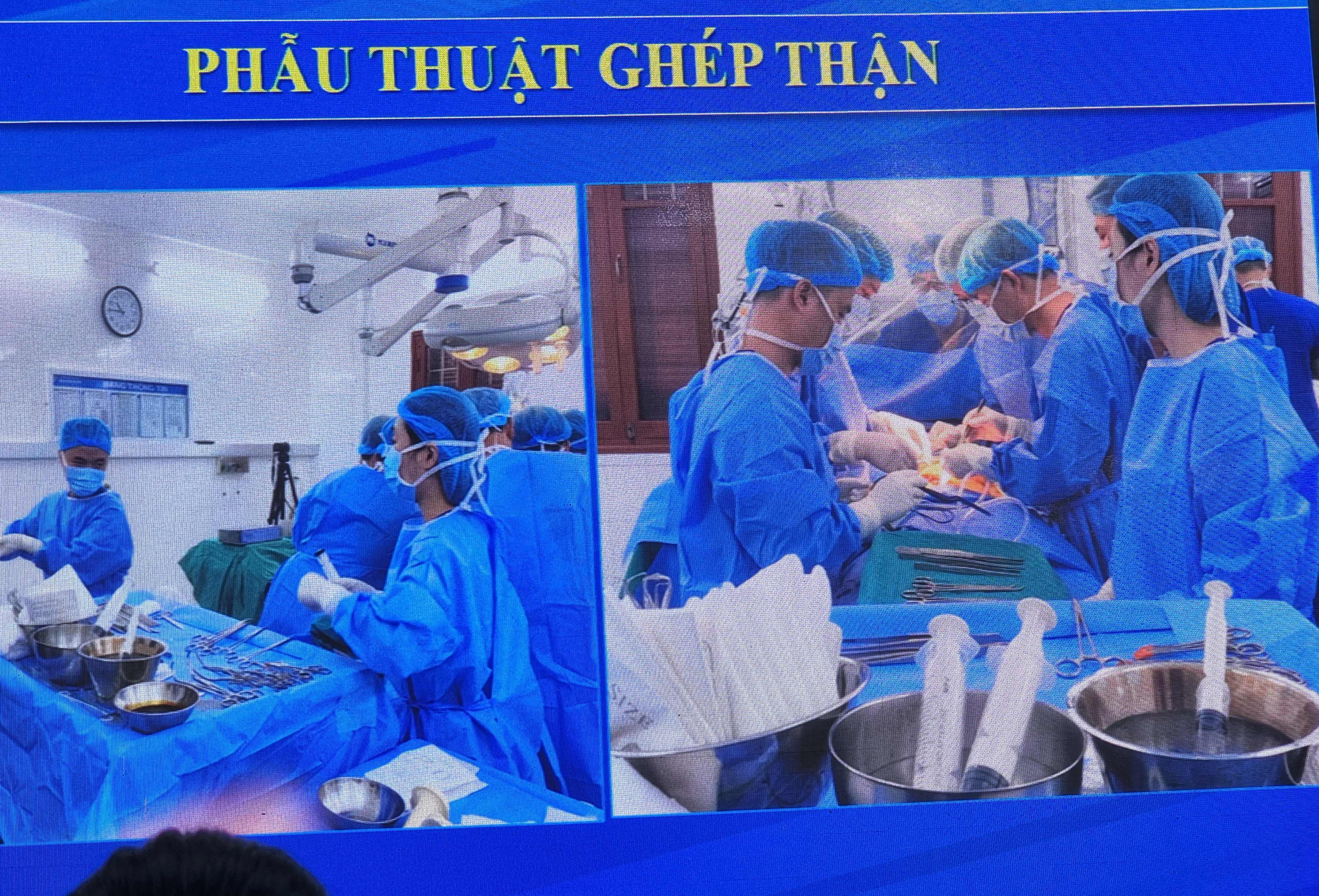 Bệnh viện Hữu nghị Việt Tiệp Hải Phòng phẫu thuật thành công ca ghép thận đầu tiên